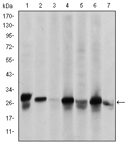 MMP1 Antibody (OAEC04809) in HEK293 (1) and MMP1-hIgGFc transfected HEK293 (2) cell lysate using Western Blot