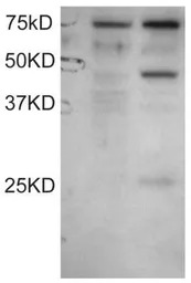 DYX1C1 (Isoform a) antibody, C
