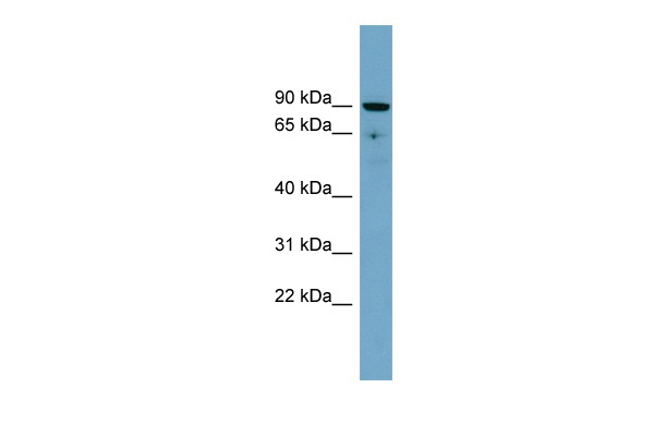 SLC26A9 antibody - middle region (ARP44082_P050) in Human PANC1 using Western Blot