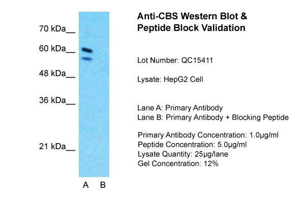 CBS antibody - N-terminal region (ARP45746_T100) in HepG2 using Western Blot