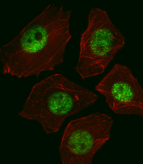 SOX2 Antibody (OAAB07021) in A549 using immunofluorescent