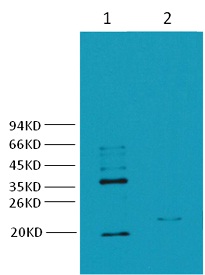 CA IX/Carbonic Anhydrase IX Mo