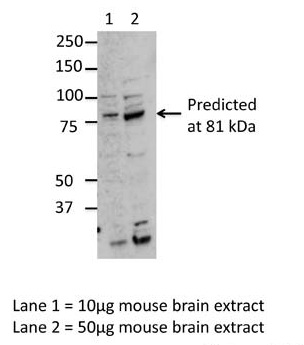 MARK3 antibody - middle region (ARP56343_P050) in Mouse Brain using Western Blot