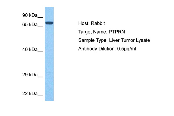 PTPRN antibody - middle region (ARP45381_P050) in Liver Tumor using Western Blot