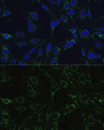 COX5B antibody