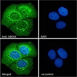 ABCA4 antibody, C-term