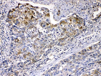 Cytokeratin 14/KRT14 Antibody 