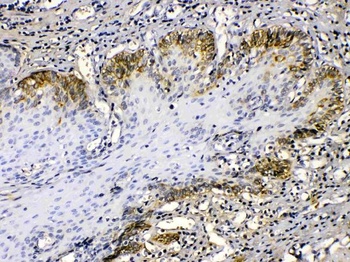 Cytokeratin 14/KRT14 Antibody 
