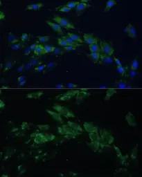 EphA4 antibody