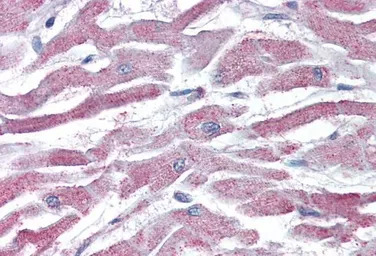 AKT3 antibody, Internal