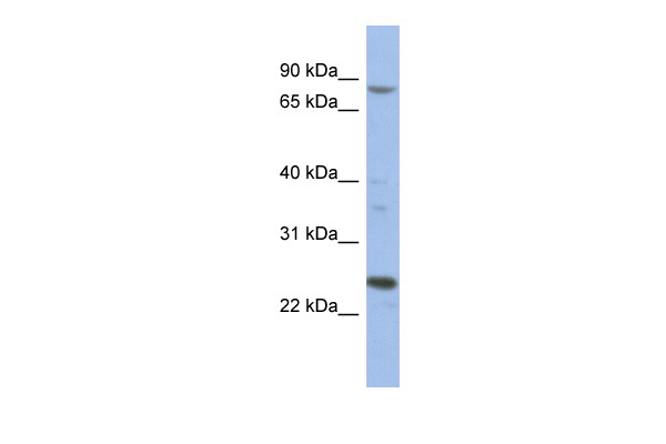 MARK3 antibody - middle region (ARP56343_P050) in Human 293T using Western Blot