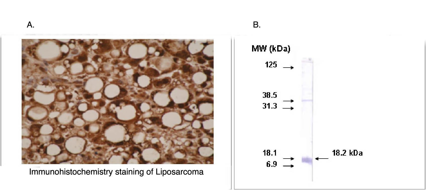 CYP26A1 Antibody (OAEG00289) in liposarcoma using Western Blot
