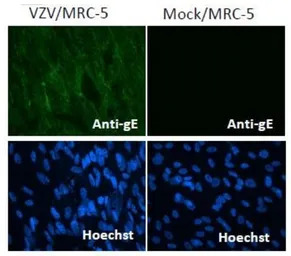 Varicella Zoster virus gE anti