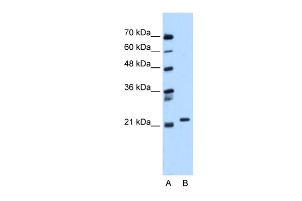 RAB11B antibody - C-terminal region (ARP48246_P050) in Human Jurkat using Western Blot