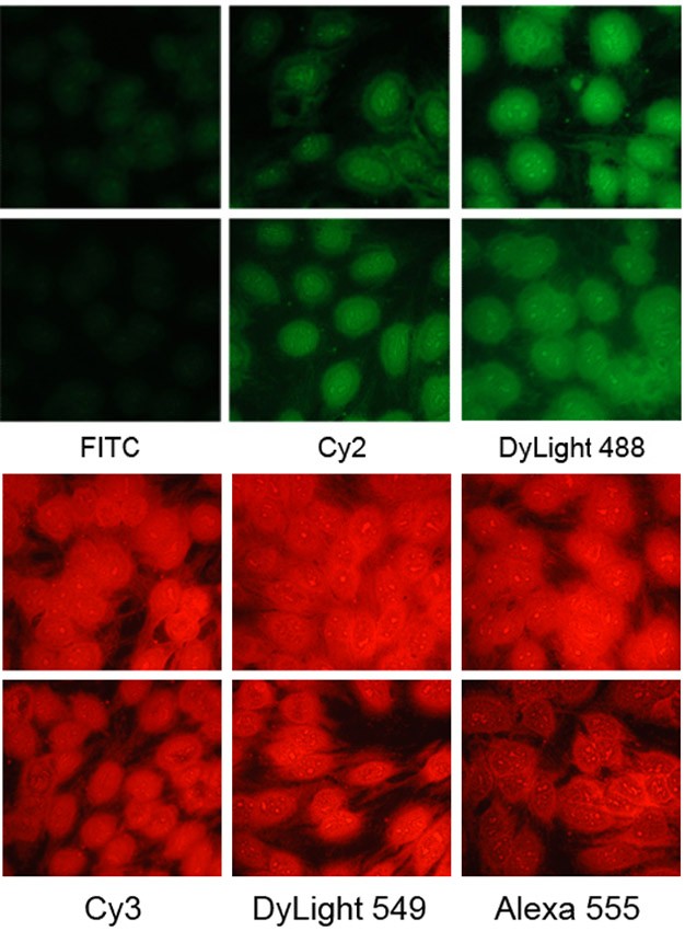 Fig.1.DyLight fluorescent dyes are a new family of dyes with improved brightness. DyLight 488-antibody conjugates are brighter than Cy2 and FITC conjugates and similar in brightness to Alexa Fluor 488 conjugates.DyLight 549-antibody conjugates shows brighter infuoresence than TRITC conjugates. Also, DyLight 594-antibody conjugates are noticeably brighter than Alexa 594 conjugates, and much brighter and more water soluble than Texas Red conjugates.