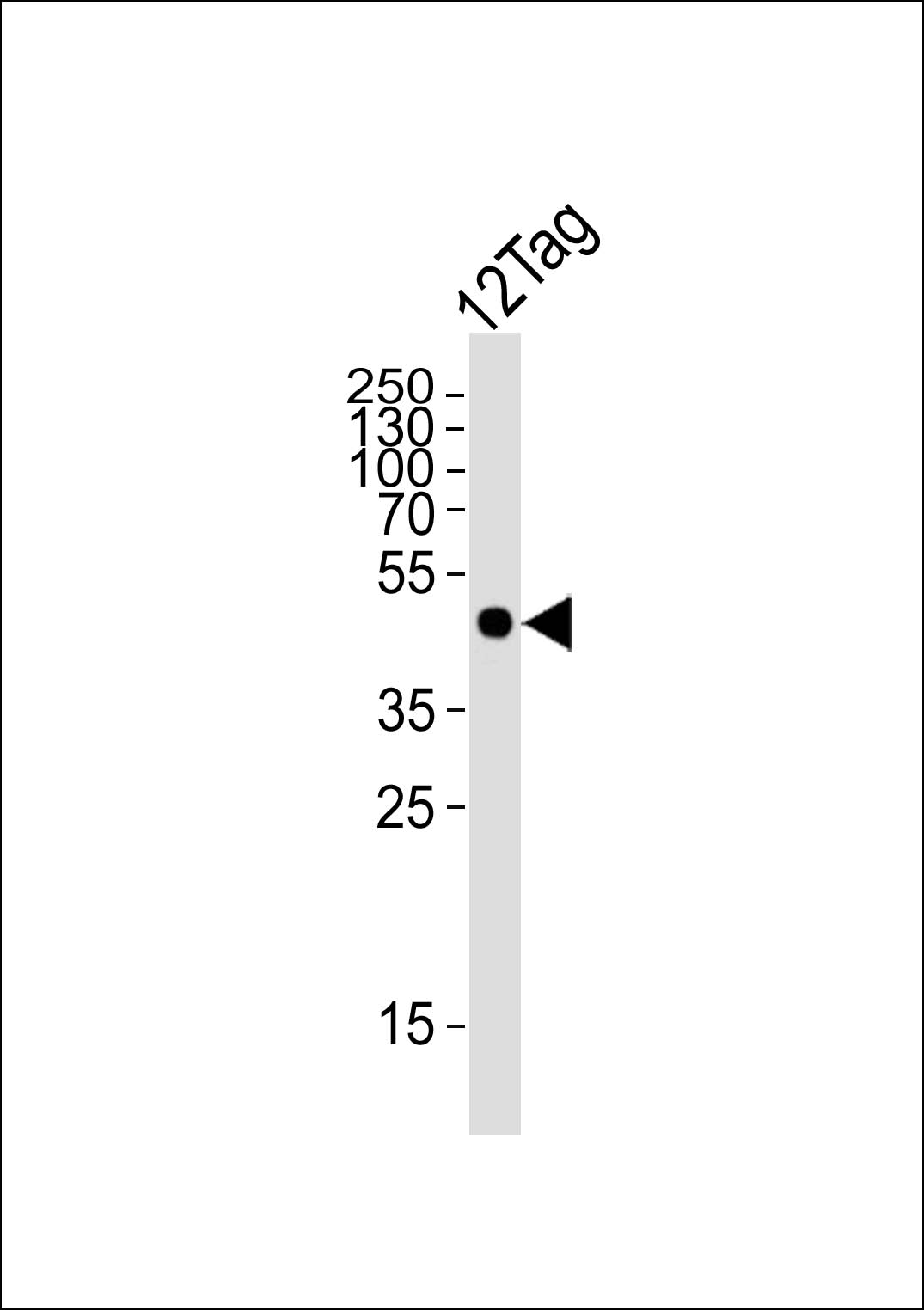 HIS Tag antibody (OAAB06612) in 12tag protein using Western Blot
