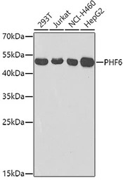 PHF6 antibody