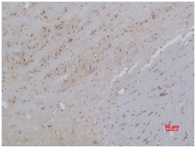 Cav β3 Rabbit Polyclonal Antib