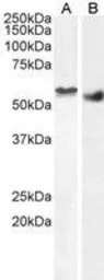 Clik1 / STK35 antibody, C-term