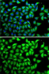 Suppressor of Fused antibody