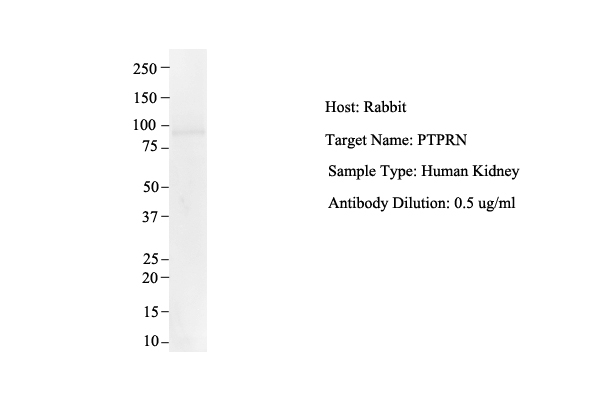 PTPRN antibody - middle region (ARP45381_P050) in Human Kidney using Western Blot