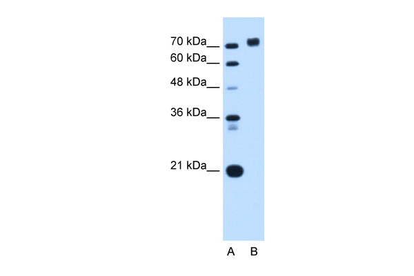 PTPRN antibody - middle region (ARP45381_P050) in Human HepG2 using Western Blot