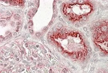 VPS11 antibody, Internal