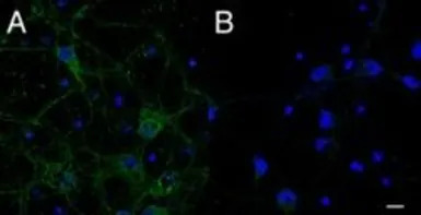 CMG1 antibody, C-term