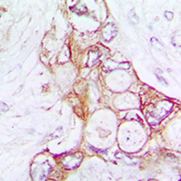 Laminin alpha 5 antibody