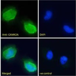 CaMKII alpha antibody, Interna