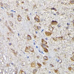 MTHFD1L antibody