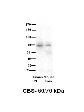 CBS antibody - N-terminal region (ARP45746_T100) in Human kidney using Western Blot