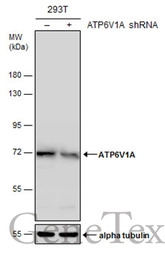 ATP6V1A antibody [GT3846]