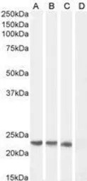 SOCS1 antibody, C-term