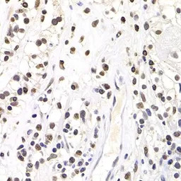 SOX5 antibody