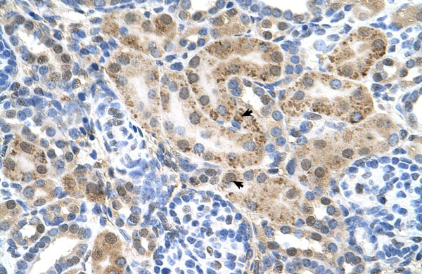 SLC22A3 antibody - N-terminal region (ARP44026_P050) in Human kidney using Immunohistochemistry