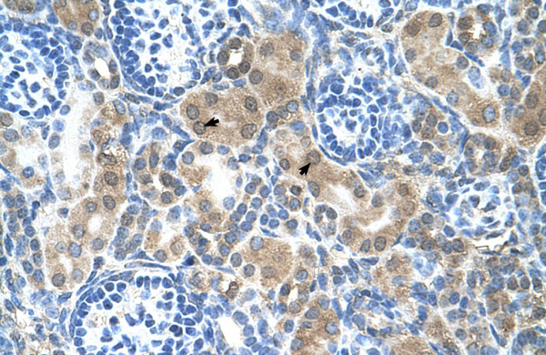 CBS antibody - N-terminal region (ARP45746_T100) in Human Kidney using Immunohistochemistry