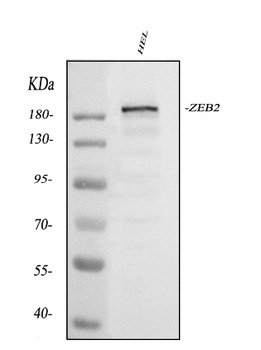Smad Interacting Protein 1/ZEB