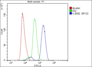 Smad Interacting Protein 1/ZEB