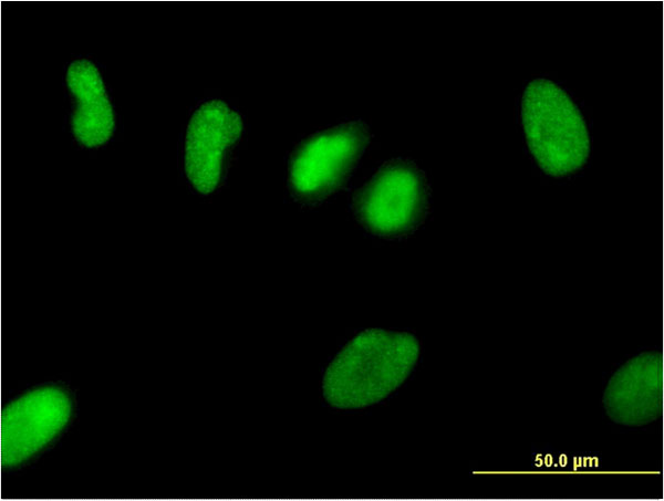 ZNF101 Antibody (OAAL00888) in HeLa using Immunofluorescence