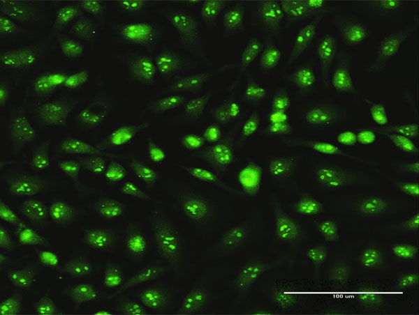 SKP1 Antibody (OAAL00303) in HeLa using Immunofluorescence