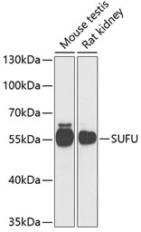 Suppressor of Fused antibody
