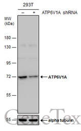 ATP6V1A antibody [GT811]