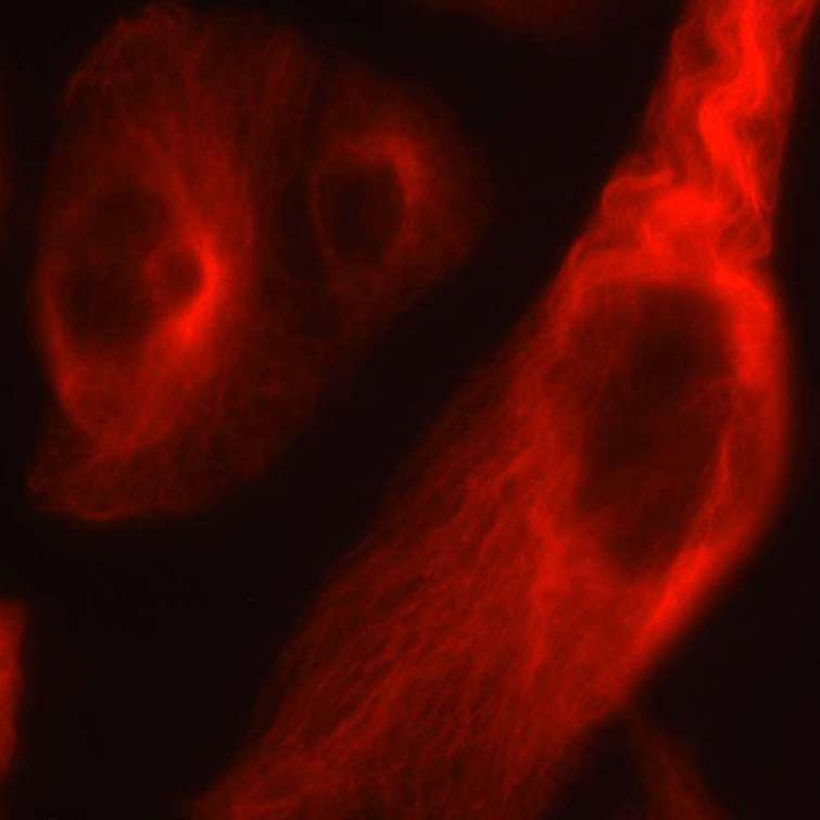 北京现货YT™免疫荧光染色二抗稀释液批发