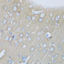 Visinin-like 1 antibody