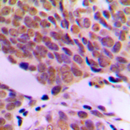 ATF2 antibody