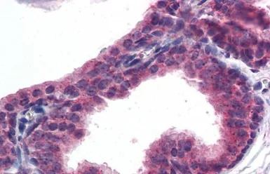 AKT3 antibody, Internal