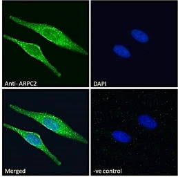 ARPC2 antibody, C-term