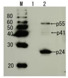HIV1 p24 antibody