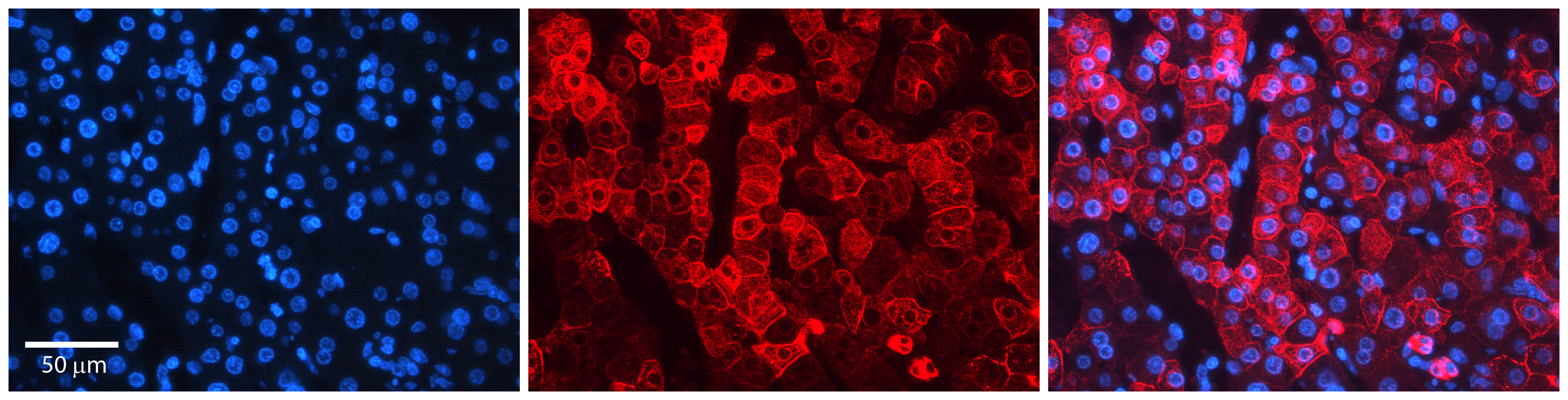 NIPA2 antibody - middle region (ARP44572_P050) in human liver tissue using Immunohistochemistry